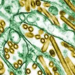 CDC potvrdio prvi slučaj teške ptičje gripe u SAD-u
