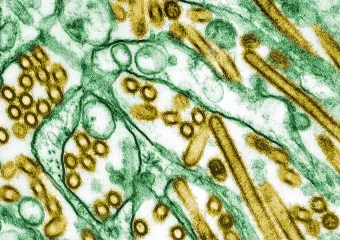 CDC potvrdio prvi slučaj teške ptičje gripe u SAD-u