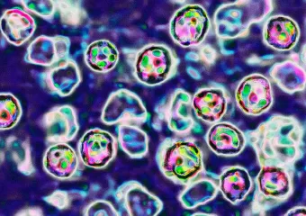 Ovako ubijaju ospice