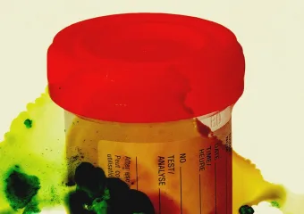 Tisuće uzoraka urina i tkiva prijeti trulo nakon što je osoblje smanjio u CDC laboratoriju