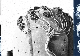 Kina gradi industriju sučelja mozga i računala