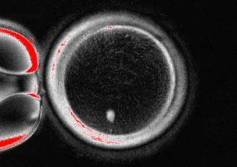 Znanstvenici su napravili ljudska jaja iz stanica kože i koristili ih za stvaranje embrija