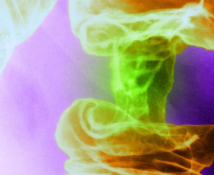 Novo svjetlosno liječenje raka ubija tumorske stanice i štedi zdrave