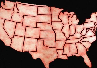 SAD čeka još jedna loša godina slučajeva ospica