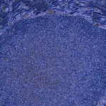 Japan odobrio prvi tretman na svijetu napravljen reprogramiranim ljudskim stanicama