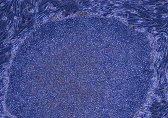 Japan odobrio prvi tretman na svijetu napravljen reprogramiranim ljudskim stanicama