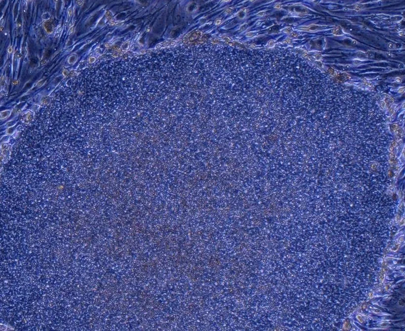 Japan odobrio prvi tretman na svijetu napravljen reprogramiranim ljudskim stanicama