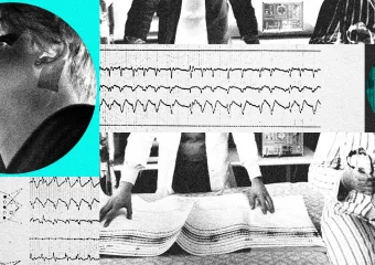 Tehnologija preoblikuje liječenje apneje za vrijeme spavanja